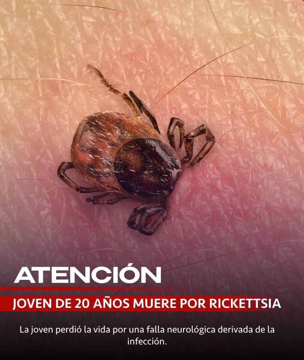 Fallece Joven Duranguense por Rickettsia: Alerta Sanitaria en la Región.